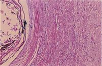 圖3：左側為角質與毛狀結構，中央為纖維結締組織與肌纖維，右側為神經組織。