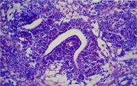 圖4：腎胚瘤， SD雄鼠，43週齡，可見成巢狀或島狀嗜鹼性胚芽細胞圍繞中央空腔，空腔邊緣有一分化較佳單層細胞形成。在巢狀腎胚芽細胞之間有疏鬆結締組織浸潤。