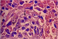 圖5：脾臟網狀內皮細胞之嗜鹼性核內包涵體。(箭頭) (H & E stain, 1000X) 