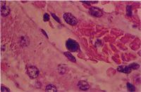 圖6：腎臟血管內皮細胞之嗜鹼性核內包涵體。(H & E stain, 400X) 