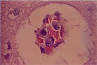 圖6：腎臟血管內皮細胞之嗜鹼性核內包涵體。(H & E stain, 400X) 