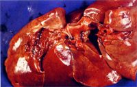 圖2：肺臟溼重潮紅，肺動脈內可見白色心絲蟲之蟲體寄生。