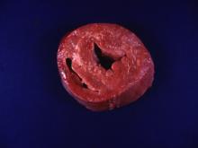 圖4：死亡仔牛剖檢可見細長條狀或帶狀黃白色病灶散佈於心肌。