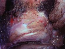 圖3：口蹄疫病牛牙齦潰瘍。