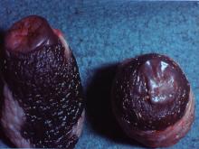 圖5：口蹄疫病牛乳頭水泡。