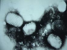 圖4：唇組織製成乳劑行負染色，於電顯下可檢出Parapox Virus病毒顆粒。