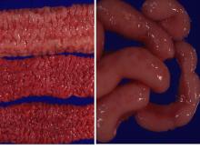 圖2A：小腸後段黏膜呈多皺摺樣，黏膜組織明顯增厚、充出血。圖2B：腸繫膜淋巴結腫大。
