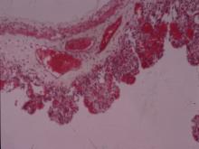 圖4：腸管黏膜壞死，嚴重充出血。