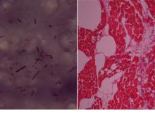 圖3A：遠心沈澱後之菌液以芽胞染色可見長桿菌及芽胞呈卵圓形位於菌體中央。3B：可見橫紋肌有局部壞死性，肌束間可見氣腫病變。