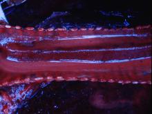 圖4：氣管黏膜潮紅，腔內佈滿帶血泡沫狀液體。