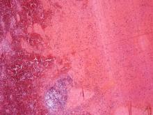 圖6：脾臟：在大區域出血區可見一對呈竹節樣排列之齊頭桿菌，但皆無明顯之炎症反應。