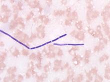 圖8：血液抹片經Wright