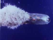 圖2：天鵝鼻周圍有痘樣病灶。