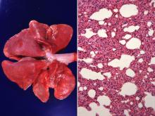 圖2A：肺臟外觀較灰白。2B：肺臟：間質細胞增生。  