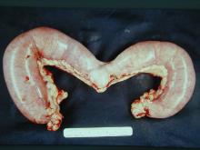 圖1：母犬，2歲，子宮蓄膿症，子宮體及兩側子宮角膨大。