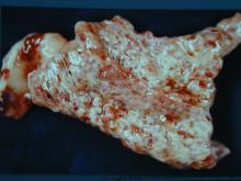 圖2：母犬，2歲，子宮蓄膿症，子宮角切開可見腔內充滿血樣、膿樣分泌物，子宮內膜水腫，子宮內膜腺體囊腫性增生。 