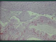 圖3：母犬，2歲，子宮蓄膿症，子宮腔及子宮黏膜腺體腔內蓄積大量粘性及膿性滲出物。