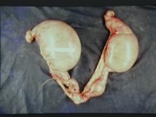 圖5：母犬，9歲，子宮蓄膿症，子宮體及子宮角明顯膨大，尤其靠兩側子宮角之前1/2段膨大更為明顯。