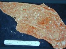 圖6：母犬，9歲，子宮蓄膿症，子宮角切開可見血樣、膿樣分泌物，子宮壁明顯變薄，子宮內膜表面瀰漫散佈點狀火山口樣之潰瘍灶。