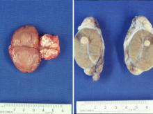 圖2A：肛門右側腫塊切面為淡褐色柔軟的均質組織。圖2B：左側睪丸切面可見一直徑為6 ㎜的黃橙色球狀團塊，呈柔軟均質樣且突出於表面。 