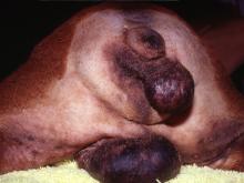 圖1：陰囊腫塊和肛門右側之懸垂