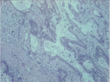 圖3.：圖2高倍鏡檢。 