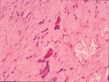 圖8：淋巴結切片經PAS染色可見粉紅色圓形黴菌菌體。