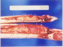 圖1：肝臟表面有少量纖維素附著，並可見大潰瘍灶。