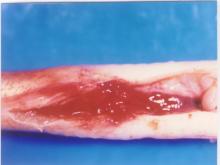 圖2：後腎腫大突起。 