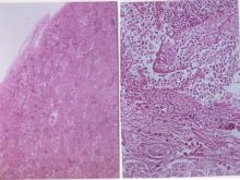 圖3A：罹病魚隻肝臟充血表面可見大量纖維素附著。 3B：罹病魚隻肝臟實質可見大區域壞死灶。 ) 