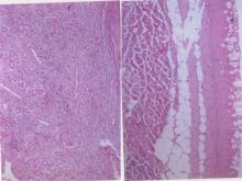 圖4A：腎臟：實質區域壞死大量單核球及少量異嗜球浸潤。4B：皮膚：表皮層杯狀細胞增生。 )