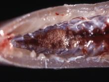 圖2：後腎腫大見灰白色結節密發。