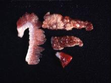 圖3：心、脾、腎、鰓等組織有0.1-0.2公分直徑之灰白色結節密發。