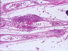 圖6：鰓絲局部壞死、融合
