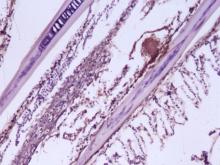 圖8：免疫化學染色於鰓絲壞死區有黃棕色陽性反應。