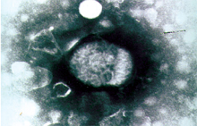 圖1：採集病變之皮膚研磨成乳劑進行電子顯 微鏡負染色檢查，可發現大型且被膜呈 特殊管狀排列之病毒顆粒。