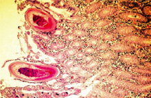 圖4：大腸切片可見鞭蟲蟲體鑽入黏膜表層， 並伴隨大腸纖毛蟲。(100×)