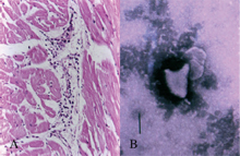 圖4：局部輕微心肌炎(圖A)。病材（關節液、 血液、臟器乳劑）接種於BHK-21細胞， 產生CPE後以負染色於電子顯微鏡觀察 可見子彈狀大小約180x120nm之病毒顆 粒(圖B)。