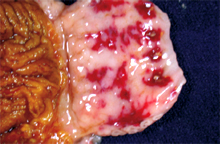 圖1：腺胃黏膜面可見多發潰瘍灶及出血