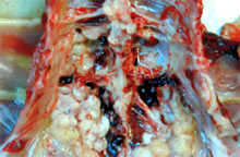 圖3：肝臟漿膜有一層白色偽膜覆蓋。