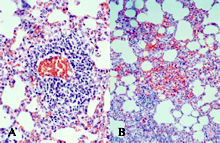 圖2：血管周圍炎（perivasculitis）（圖A），非 化膿性多發局部間質性肺炎及局部肺泡 內出血。（圖B）