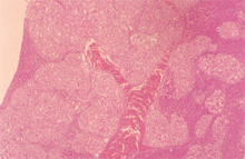 圖4：患鼠肝臟組織，由大量雙卵蓋酒桶形之 蟲卵佔據肝實質，有些區域可見成蟲切 面含生殖道及腸道，引起肝實質壞死及 肉芽腫病變。)
