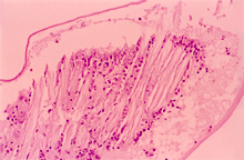 圖3：發病蝦隻泳足組織病理切片可見上皮細 胞壞死灶。（H& E 染色）。