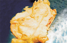 圖3：子宮外觀膨脹，剖檢子宮內含一成形之 死產胎兒。