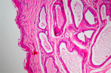 圖2：肛門囊囊壁為角化的複層扁平上皮，圍 繞著肛門囊有許多大小不一的管樣結 構，管樣結構間有結締組織將其分隔。 (H & E，100×) 