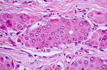 圖3：正常的圍肛腺組織，腺體由單獨堅實的 一團細胞組成，似緊密包裹的一團肝細 胞，故又稱為肝樣腺。在一團肝樣細胞 的周圍可見嗜鹼性的貯存細胞。(H & E；400 X)